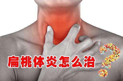 慢性扁桃体炎，到底该不该割啦？