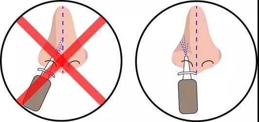 使用鼻喷雾剂，这11种错误不能犯！