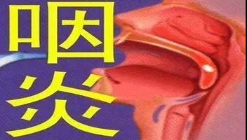 感觉咽喉有异物感