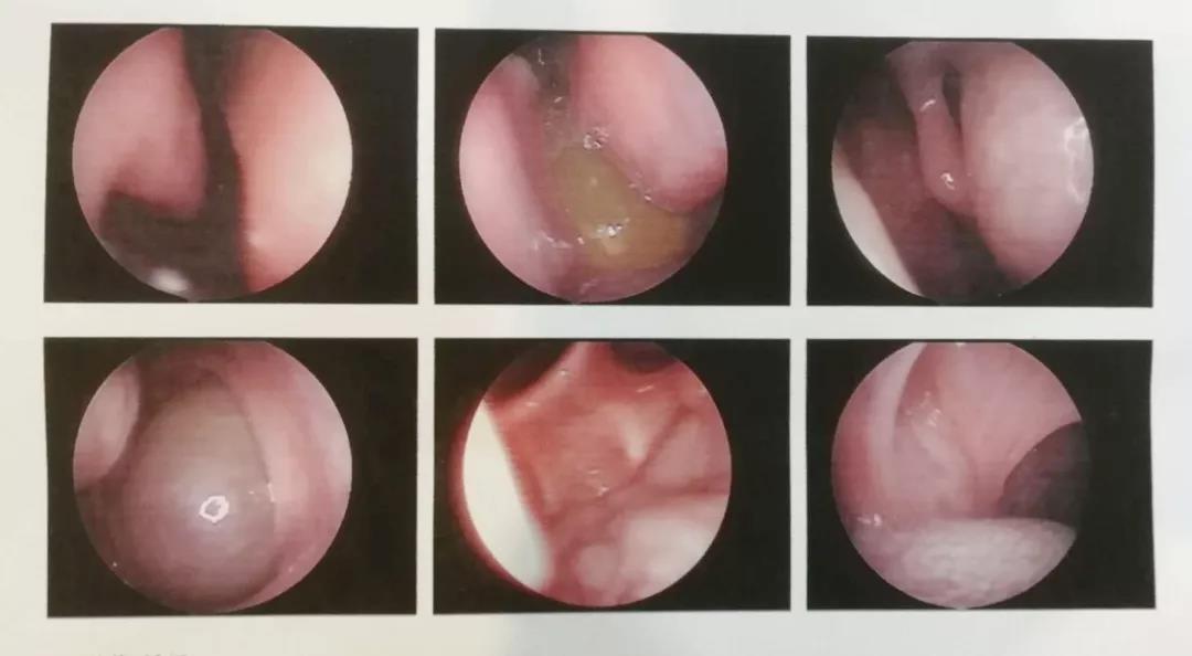 一男子“感冒”6个月还不见好转，罪魁祸首原来是TA！