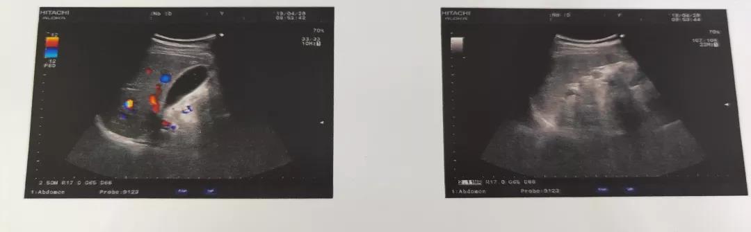 一男子“感冒”6个月还不见好转，罪魁祸首原来是TA！