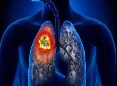 猪血、木耳，真的能除尘养肺吗？真相和大家想的不一样！