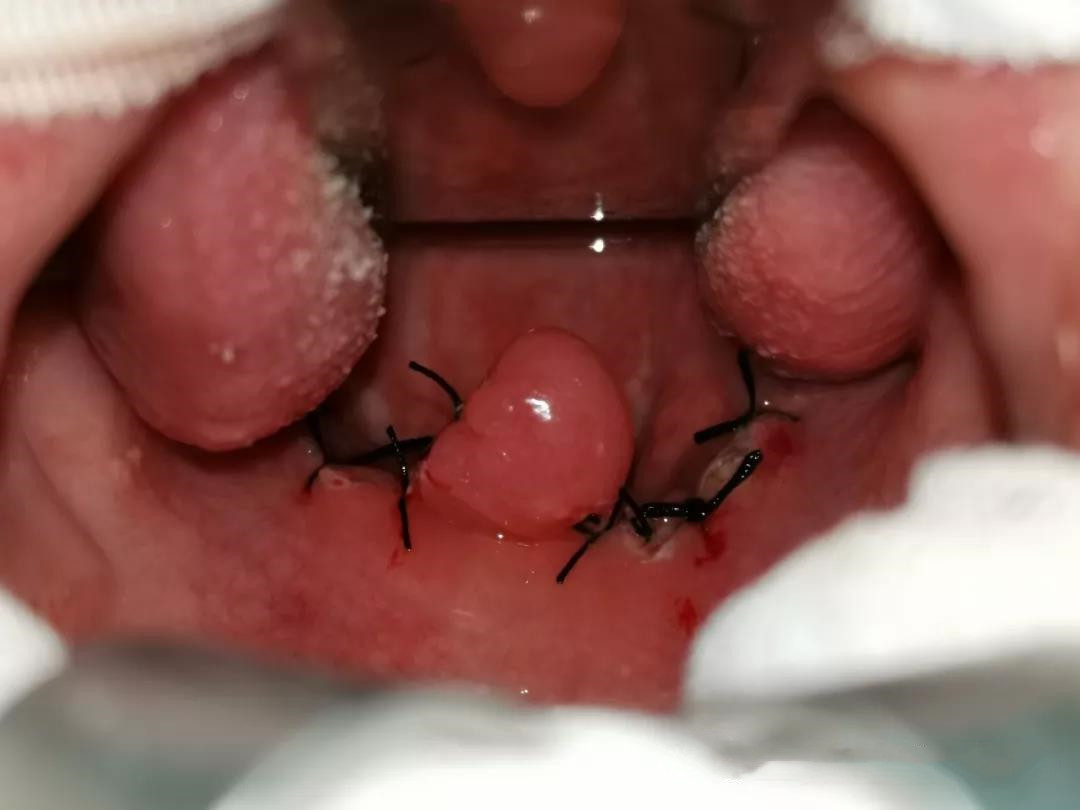 小伙躺着就醒,坐着就睡,这是为什么呢?