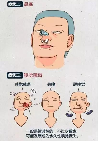 感冒or鼻窦炎？醒醒吧，别被披上伪装的鼻窦炎给弄懵啦！