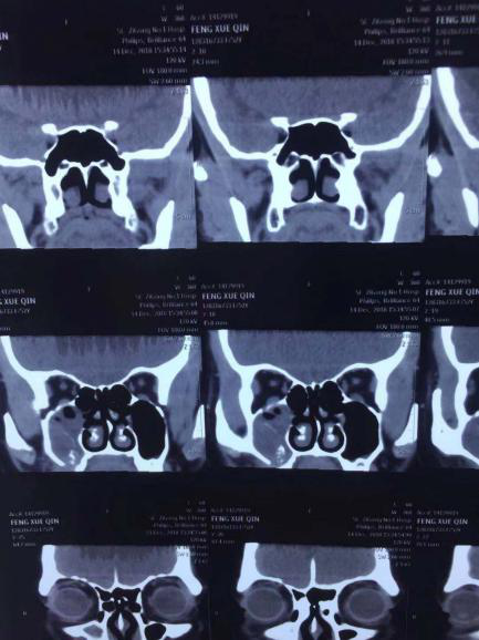 疑难病例 | 仁品专家2小时手到病除