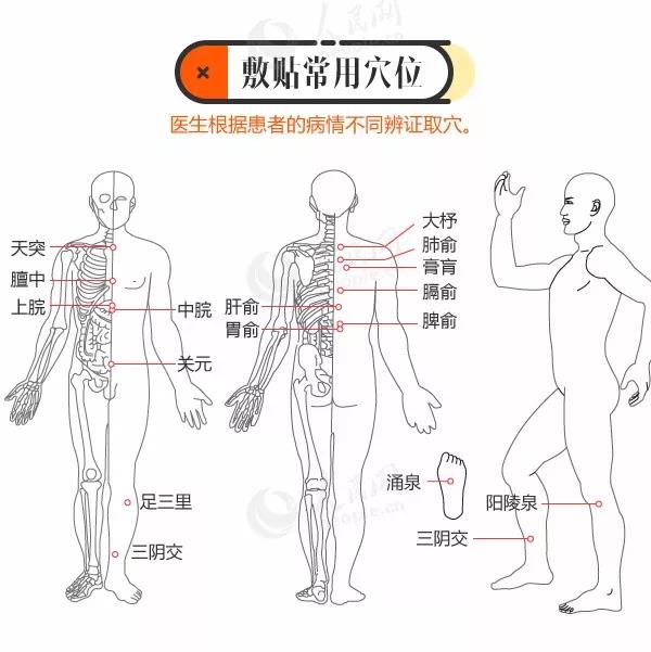 又是一年三伏到 冬病夏治正当时